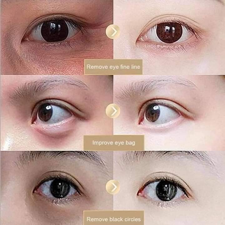 Eaoron - Propolis Eye Cream - Lemonbaby