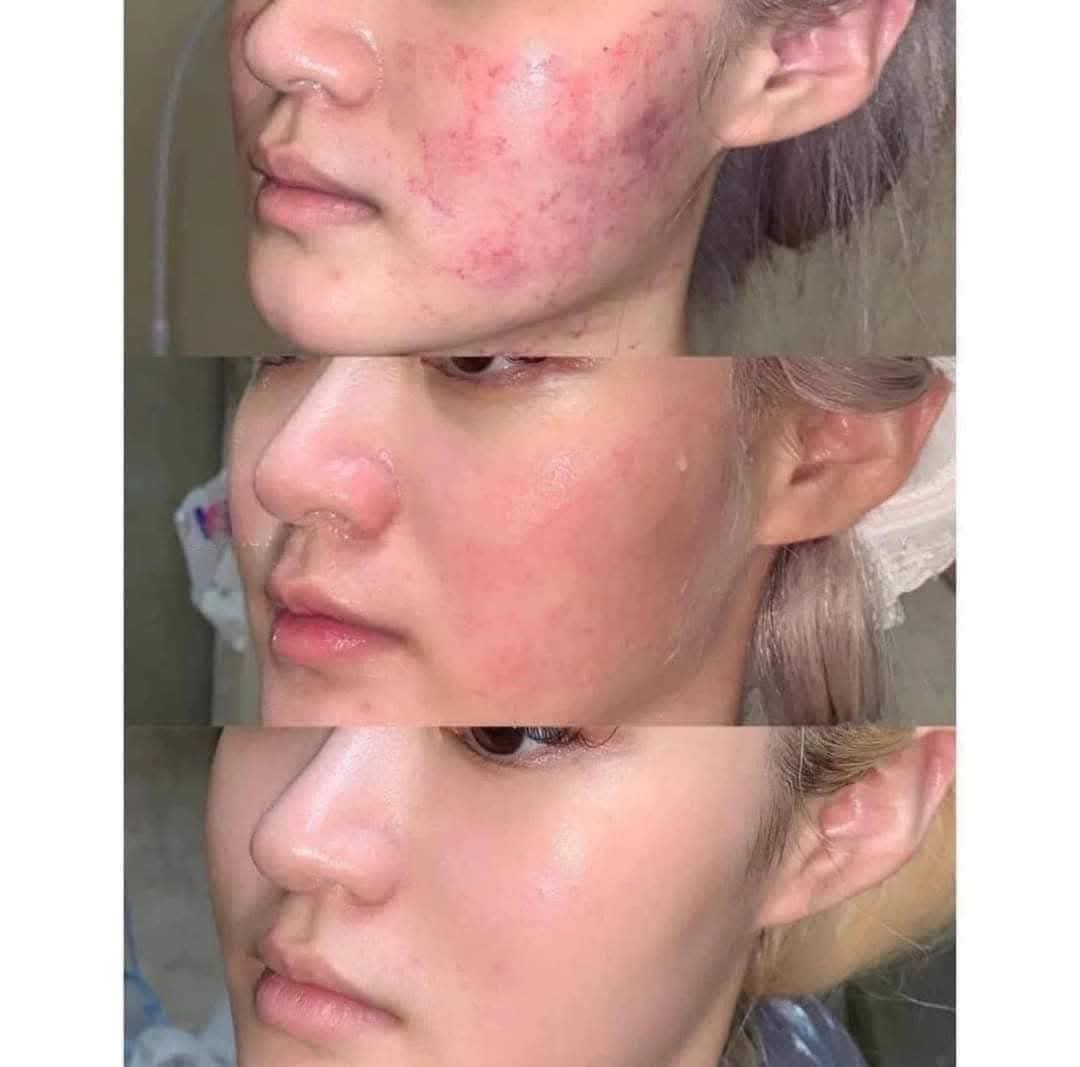 La Roche - Posay B5+ Balm - Lemonbaby