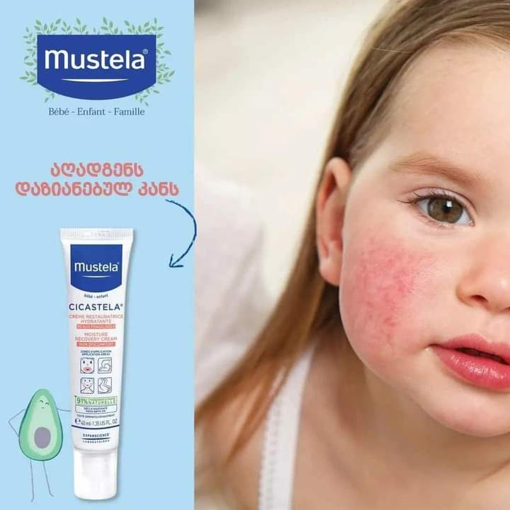 
                  
                    Mustela cicastela sos cream(40ml) - Lemonbaby
                  
                